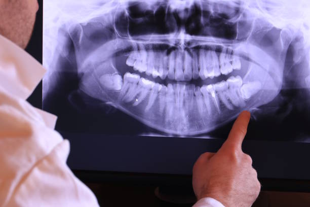 Best Emergency Tooth Extraction in Ttapoisett Center, MA